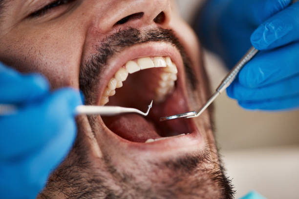 Best Emergency Cosmetic Dentistry (e.g., broken veneers) in Hartville, OH